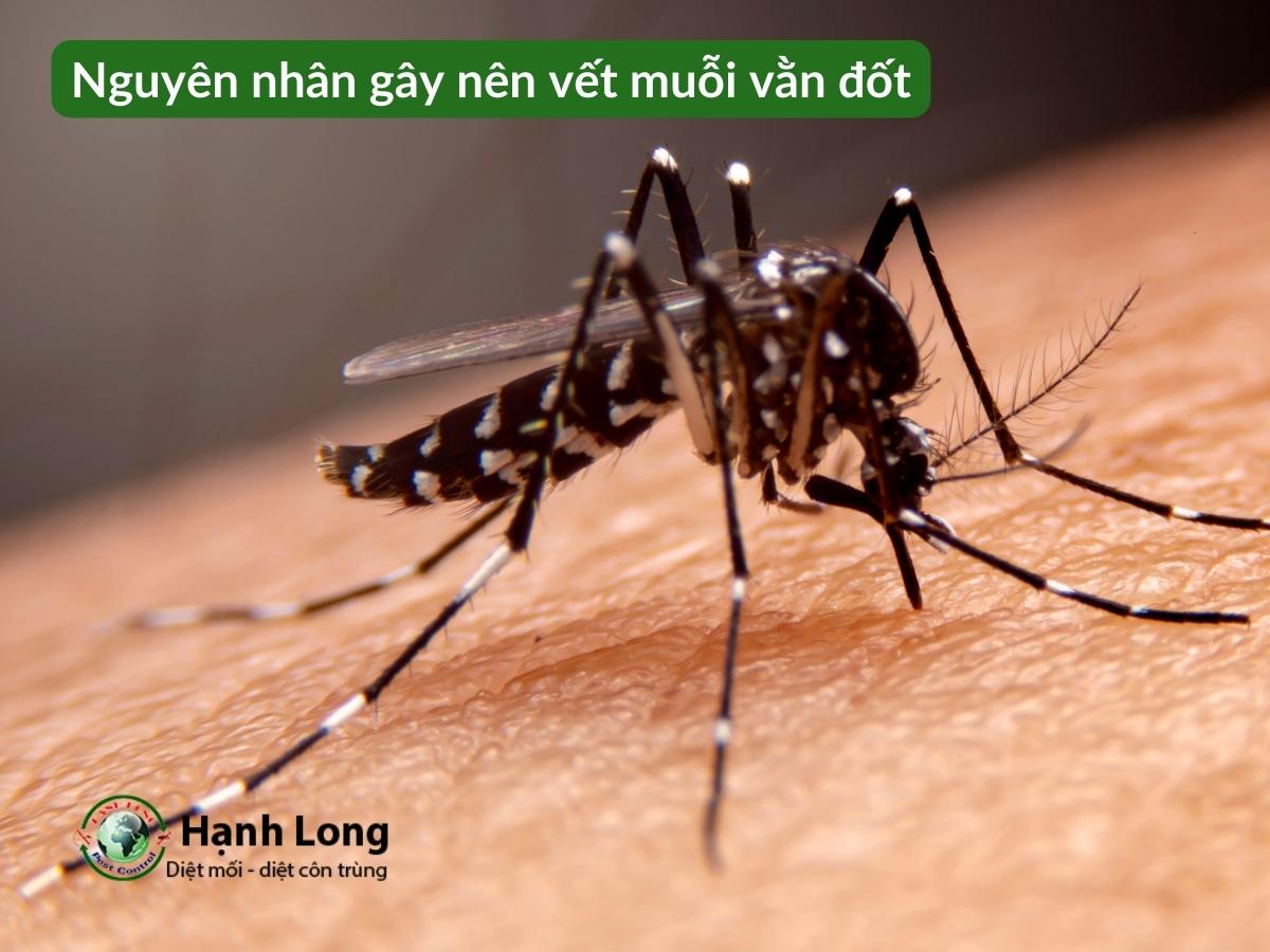Nguyên nhân gây nên vết muỗi vằn đốt