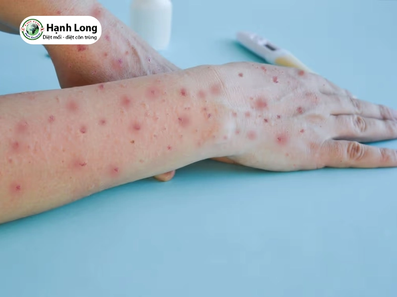 mối có cắn không