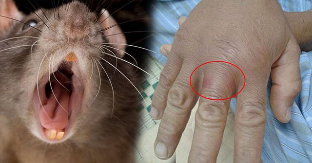 Bị chuột cắn có sao không? Cần làm gì ngay khi bị chuột cắn